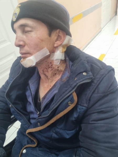 «Зарежь его!» 20 человек избили отца и двух сыновей после кокпара. Почему никто не сел?